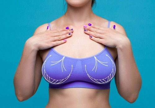The Invisible Bra Surgical Procedure Explained